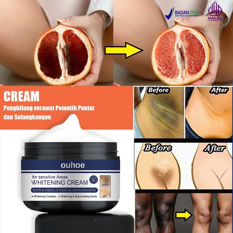 Pemutih selangkangan Pemutih miss v Memutihkan selangkangan hitam Pencerah selangkangan 30g Pemutih 