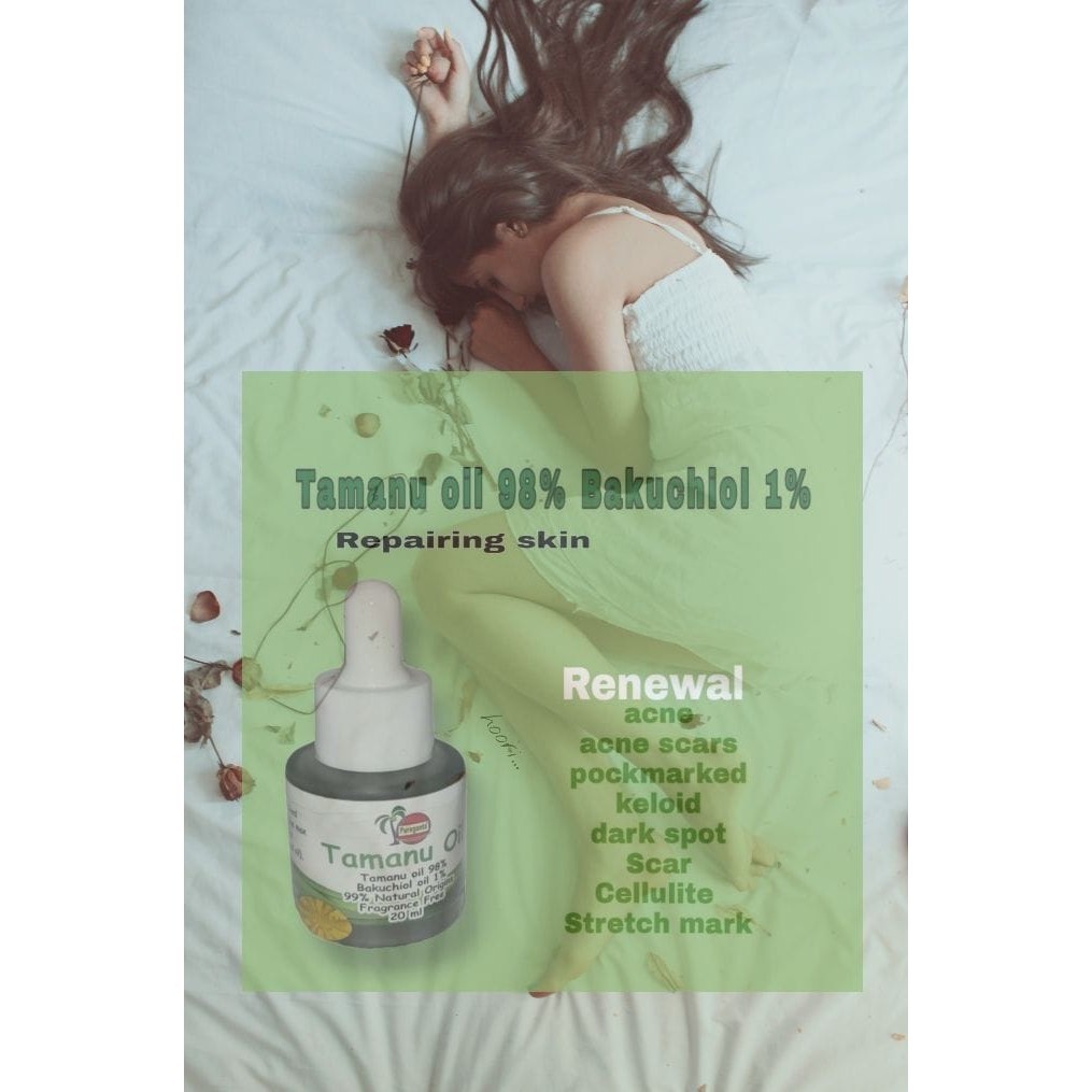 Taman oil serum-Penghilang Bekas Jerawat-Bopeng-keloid-scar luka