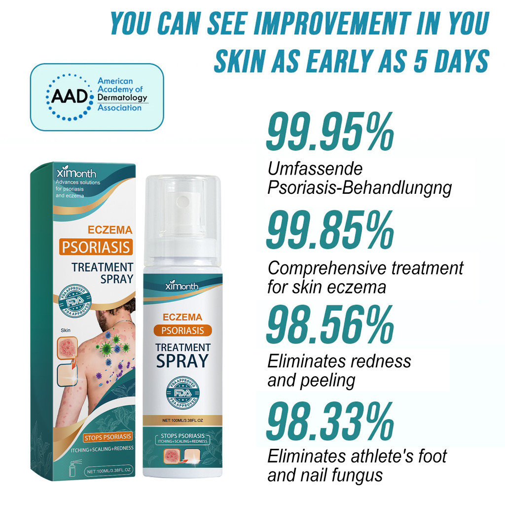 AMND Salep gatal paling ampuh Obat psoriasis obat gatal salep kutil Obat Gatal Salep gatal Salep