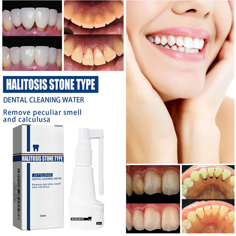 [AW]Pembersih Karang Gigi Semprotan Penghilang Karang Gigi Bandel 30ml Pembersih Gigi-COD