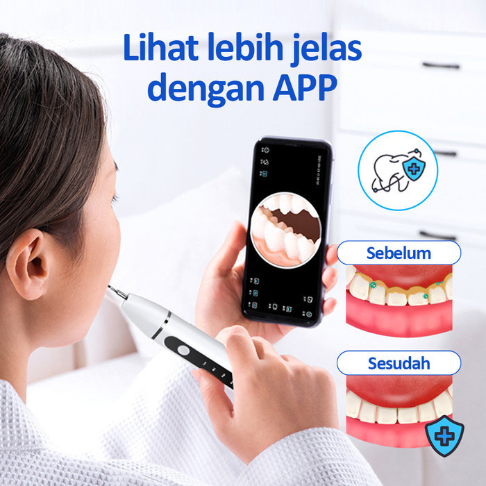 Alat Pembersih Karang Gigi Ultrasonic Smart Ultrasonic Dental Scaler - Visual scaler