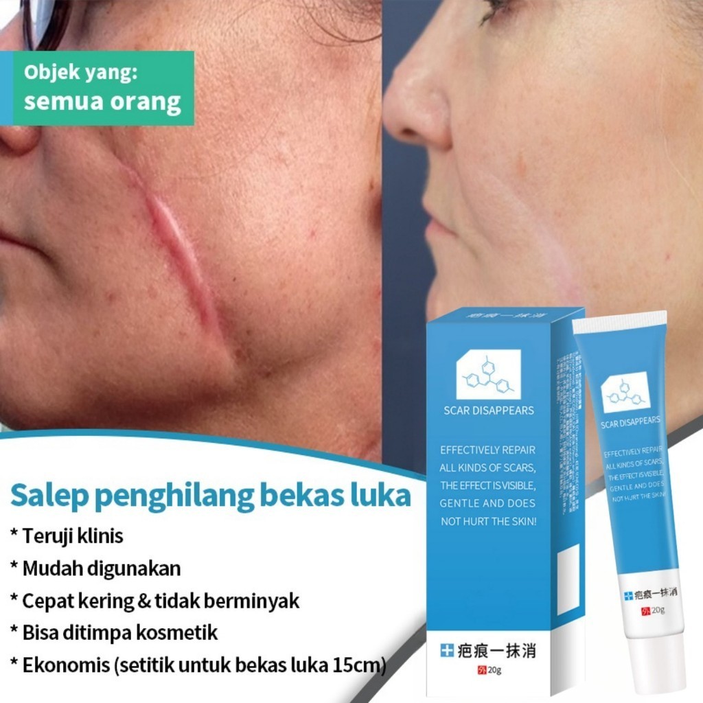 COD Salep bekas luka Obat penghilang bekas luka Salep penghilang bekas luka bekas gigitan nyamuk bek