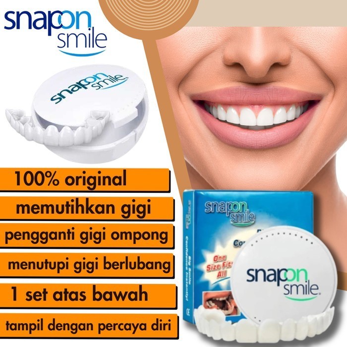 TERMURAH BOSKUU karet ikat kuat Snap On Smile 100% Original Authentic / Gigi Palsu Snapon Smile 1 Se
