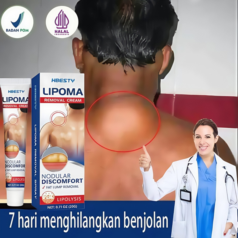 AMND Obat Benjolan Lipoma Krim lipoma OBAT OLES PENGHILANG BENJOLAN LIPOMA 20g Obat Kista Ganglion,