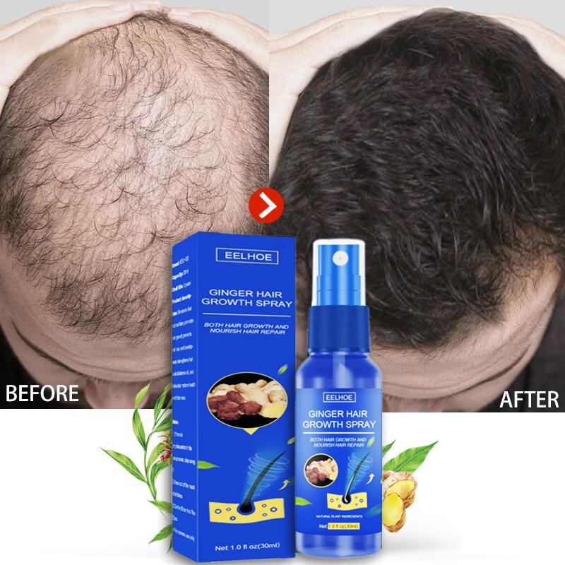 EELHOE Hair Growth Spray PENUMBUH RAMBUT Cairan Serum Penumbuh Rambut Anti Rontok / Obat rambut bota