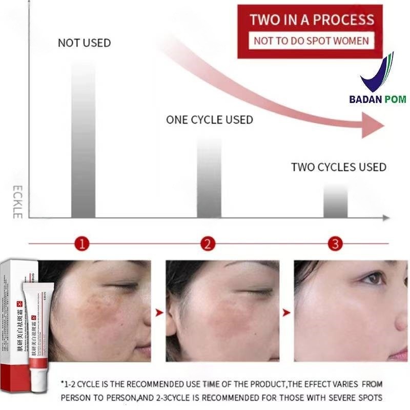 krim penghilang flek hitam di wajah salep flek hitam membandel cream flek hitam membandel perawatan