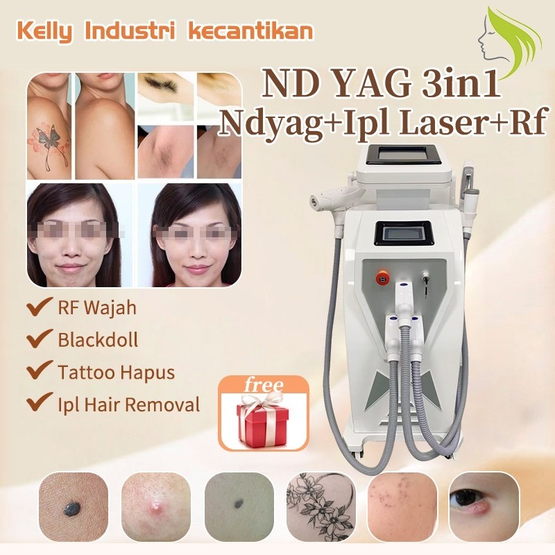 ndyag laser 3in1 ipl + rf + ndyaglaser alat klinik kecantikan laser penghilang flek bekas Jerawat la