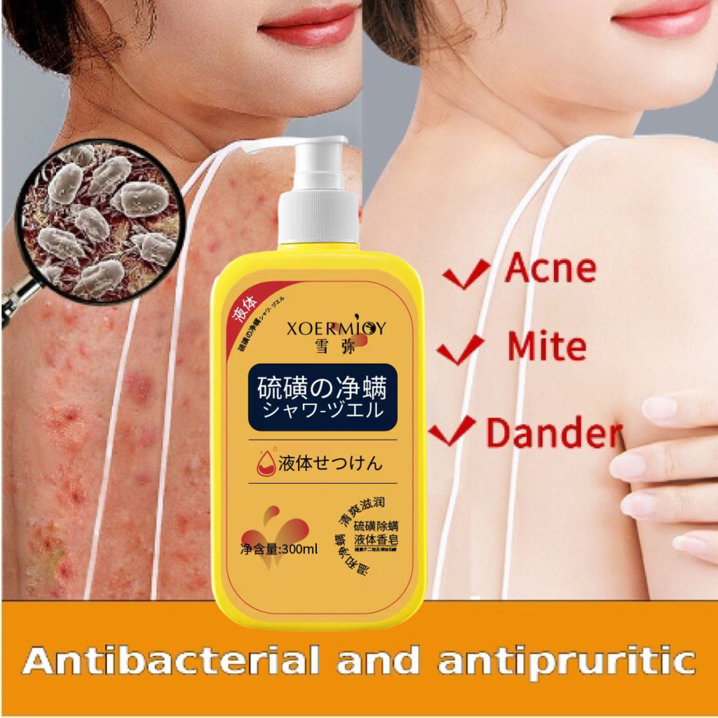 eksim bayi eksimer kuning Perawatan Kurap Kulit Mengatasi Jerawat Menghilangkan Tungau eczema body w