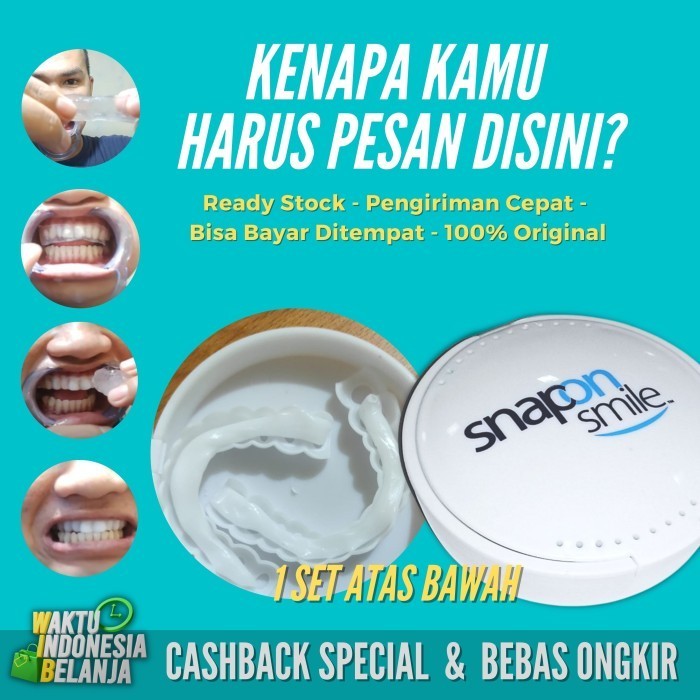 TERMURAH BOSKUU karet ikat kuat Snap On Smile Venners Gigi Original 100% 1Set Atas & Bawah Gigi Pals