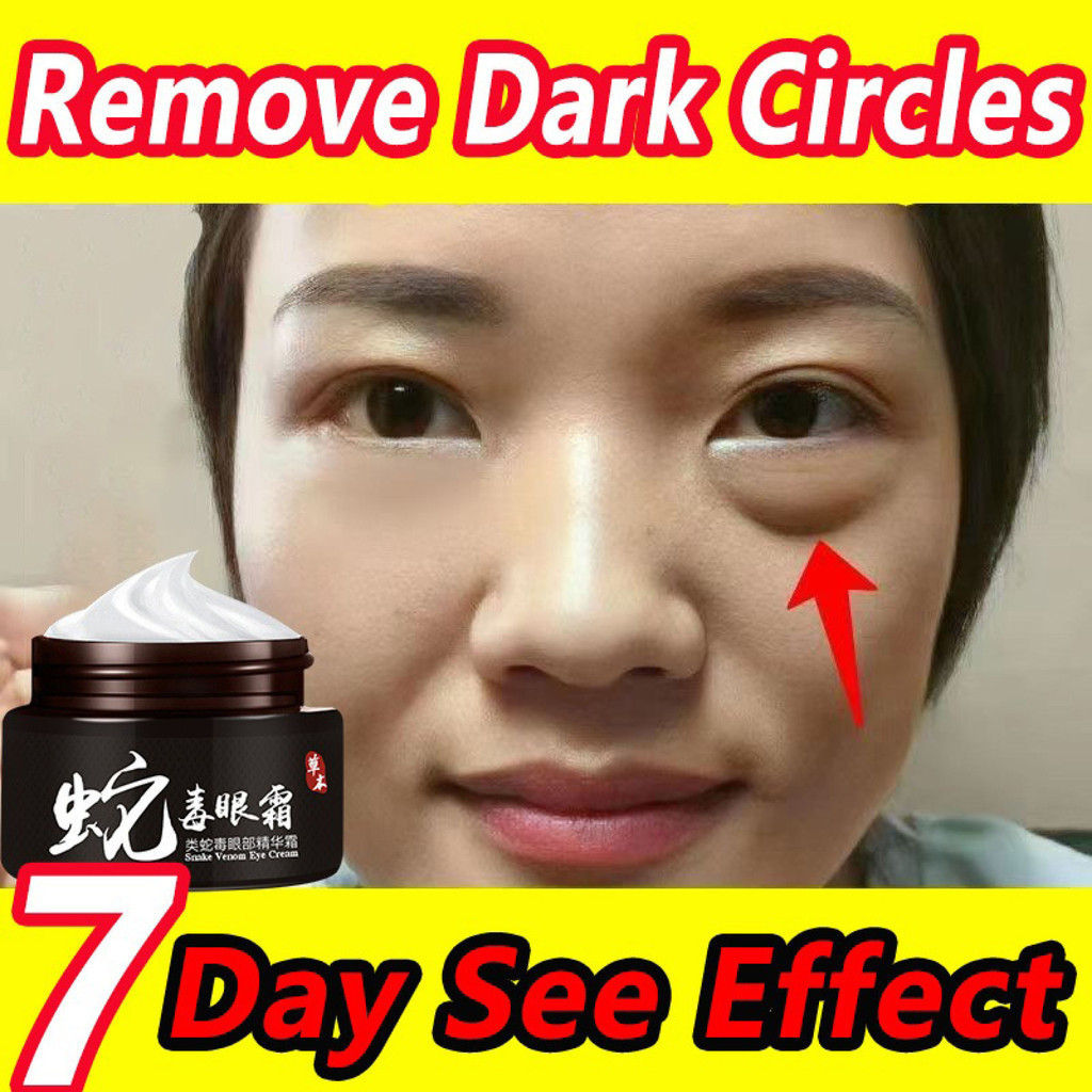 SIMU Eye Cream Cream mata bisa ular Mata hitam Krim Mata Anti-Bengkak Kerutan Perawatan Lingkaran Hi