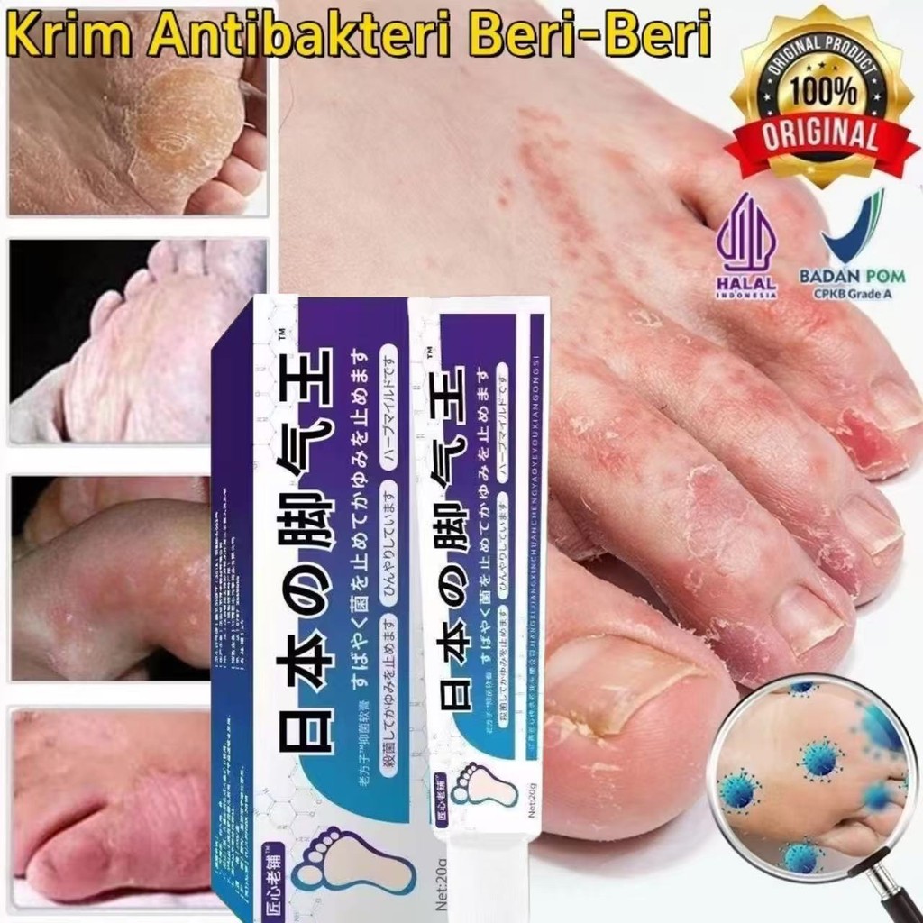 Salep Kaki Rayapan Obat Telapak Kaki Bau Bolong Penghilang Kutu Air Cream Kaki Pecah Pecah Gatal Jam