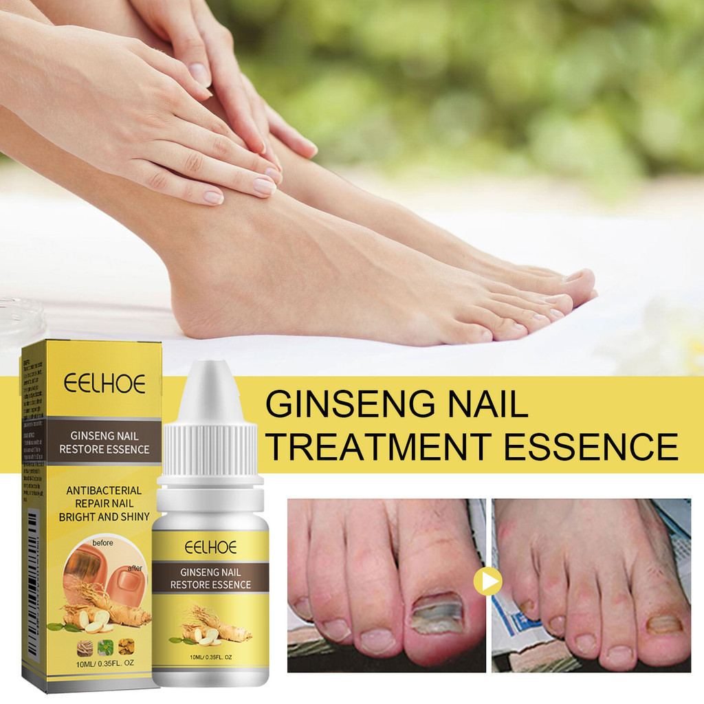 EELHOE Ginseng Nail Treatment Essence 10ml Obat Jamur Kuku Oedo Kuku Obat Perawatan Kesehatan Jamur 