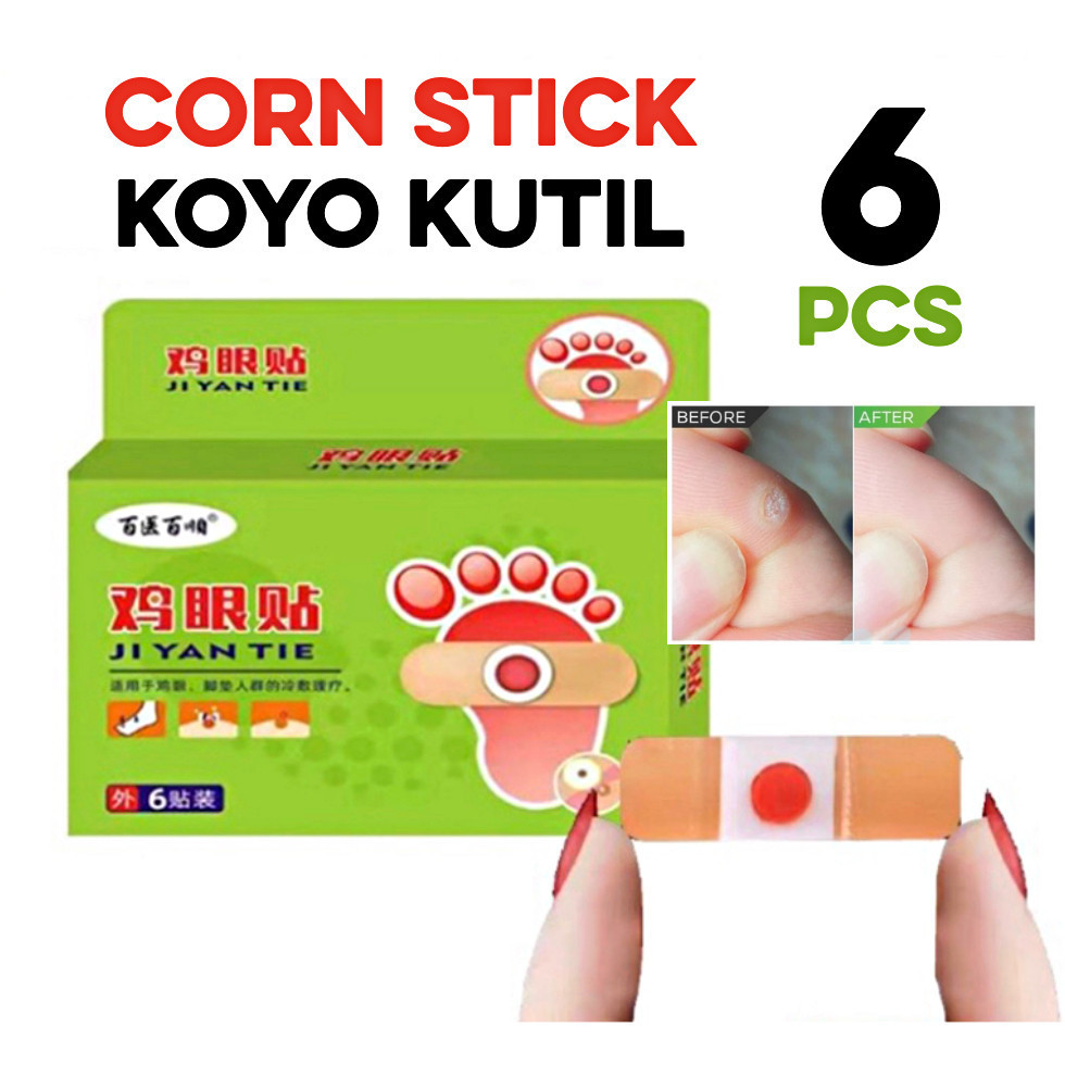 Set Plester Mata Ikan Penghilang Penyakit Kutil Penyembuh Penyakit Kulit Mata Ikan Kapalan  Foot Cor