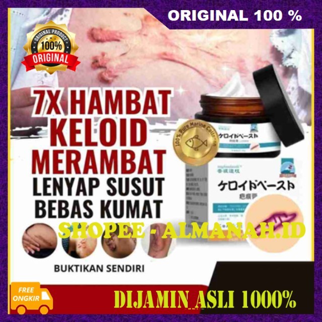 [BISA COD] Keloscar Japan Salve Cream Penghilang Bekas Luka Krim Penghilang Keloid Bopeng Bekas Luka
