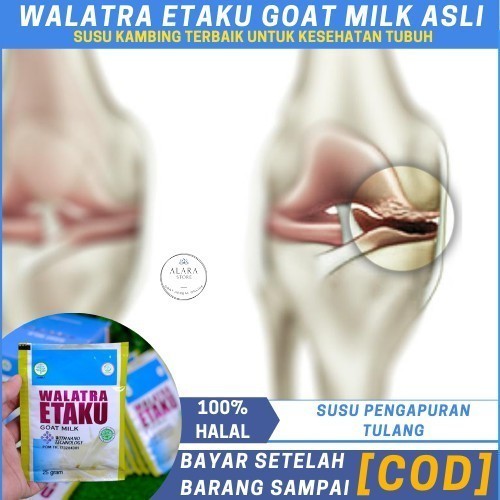 

Flashsale Etaku Disc 1 Box 45% Susu Kambing Etawa Bubuk Solusi Untuk Pengapuran Tulang Sendi, Nutrisi Tulang & Sendi, obat sakit lutut dan kaki, Nyeri Sendi, Radang Sendi, Sakit Persendian - Walatra etaku Asli 100%