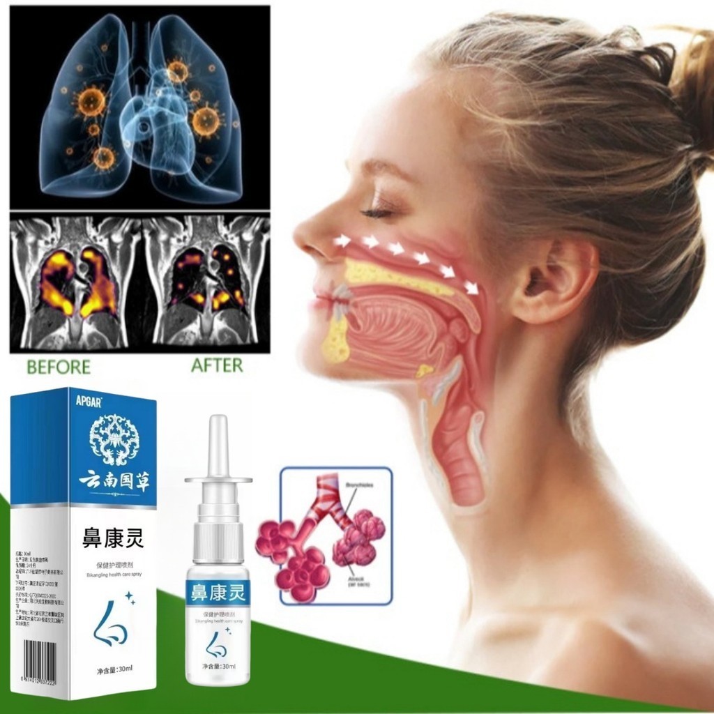 APGRA Nasal Spray Nasal Sprays Obat Sinusitis Polip Hidung Rhinitis Alergi Sinus Hidung Bau Busuk