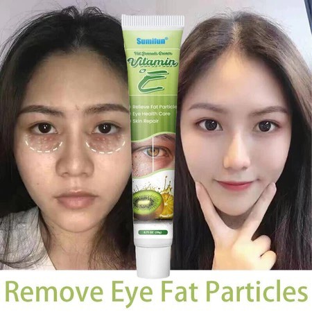 Obat milia di bawah mata cream milia penghilang milia Eye cream obat milia remover Benjolan Kecil di