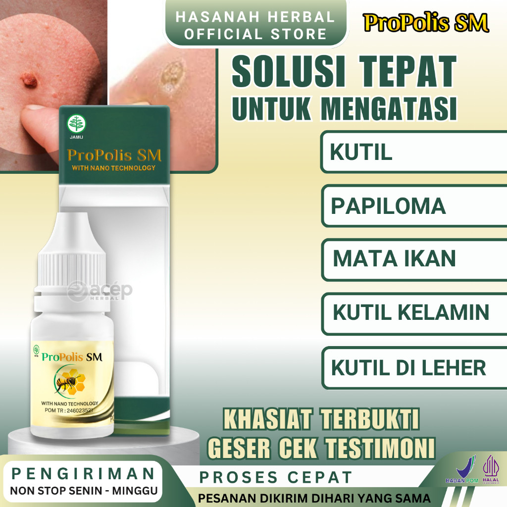 

Obat Penghilang Kutil Mata Ikan Atasi Kutil Kelamain dan Papiloma di Leher Wajah Kaki Tangan Untuk Pria Wanita Herbal Propolis SM Asli
