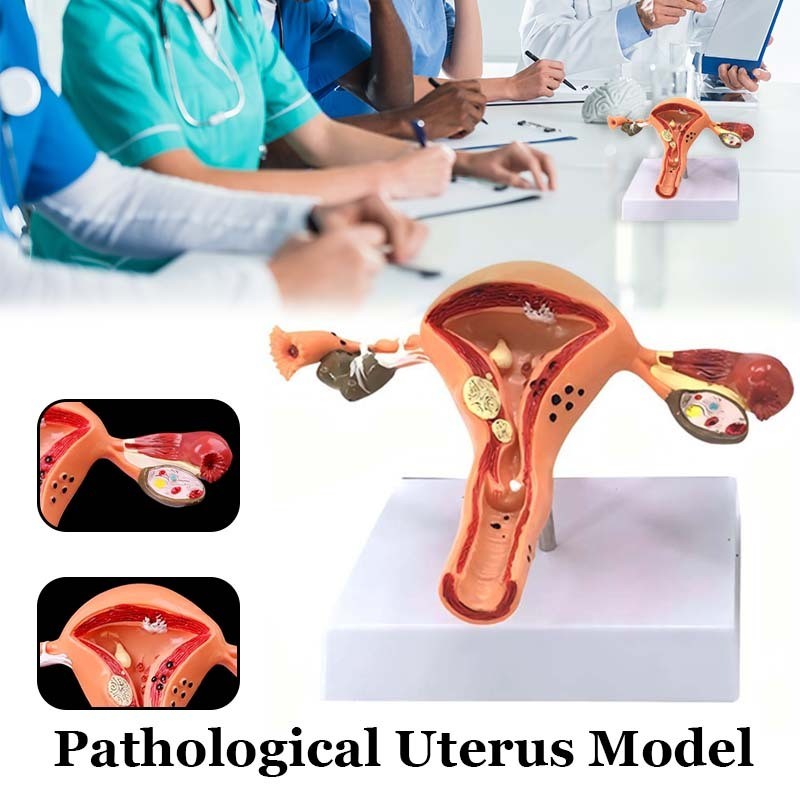 Model Anatomical Uterus Ovary Wanita / Peraga Anatomi Model Patologis Uterus Ovarium