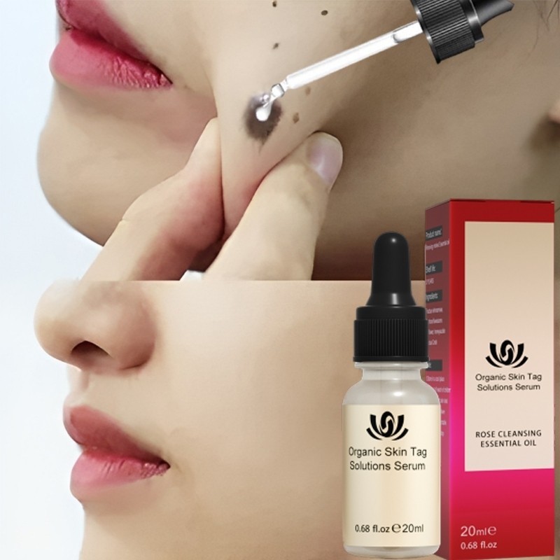 [Original] Penghilang tahi lalat obat penghilang tahi lalat penghilang kutil dan tahi lalat 20ML