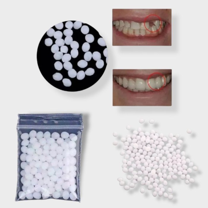 Temptooth Penambal Gigi Patah Renggang Ompong Isi ±100 Butir TCI