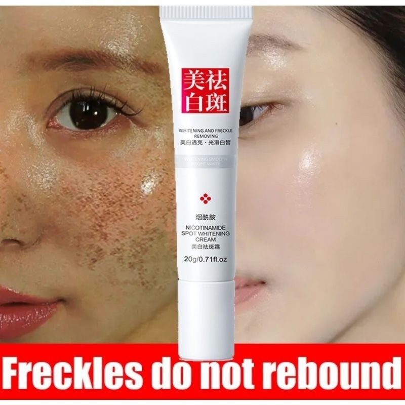 Cream Penghilang Flek Hitam Membandel Melasma ORI FUYAN Krim Salep menghilangkan Bintik Memutihkan W