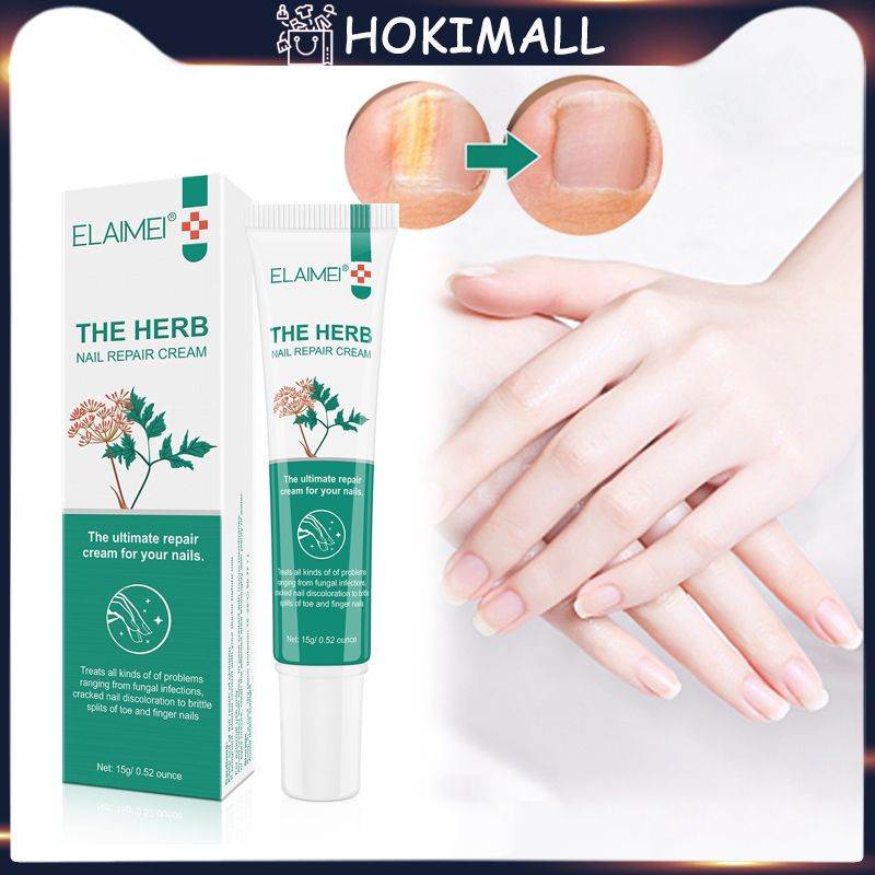 Perawatan Jamur Kuku Obat Jamur Kuku Perawatan Kuku Rusak Repair Obat Jamur Kuku Bernanah Dan Canten