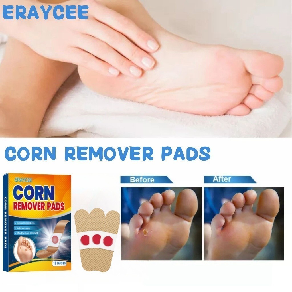 10PCS ERAYCEE Plester Kutil Mata Ikan Obat Kutil Mata Ikan Tahi Lalat Plester Kutil Penghilang Penca