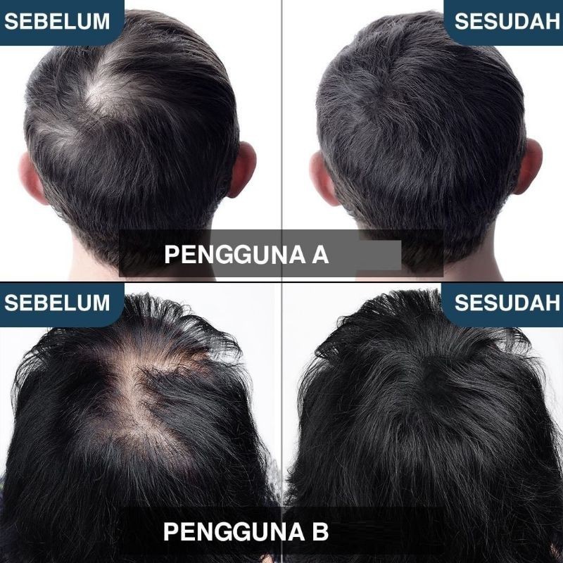 KERANIQ Hair Serum Penumbuh Penyubur Rambut Original( Gratis Ongkir & COD )
