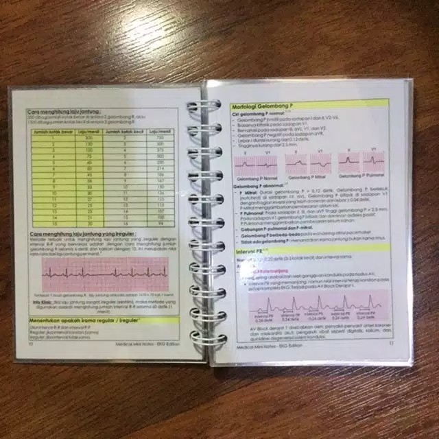 PROMO ~ Medical Mini Notes MMN EKG - Buku Saku Kedokteran