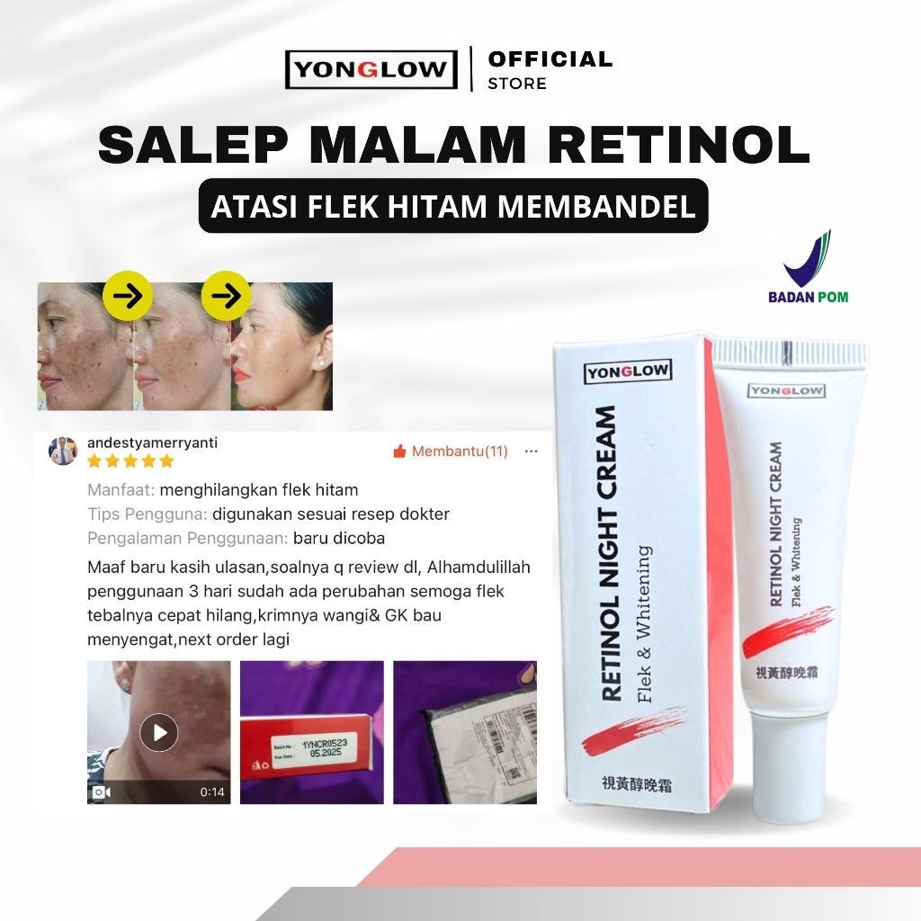 Terlaris Yonglow Salep Cina Retinol Night Cream Flek Whitening Penghilang Noda Hitam Melasma Memband