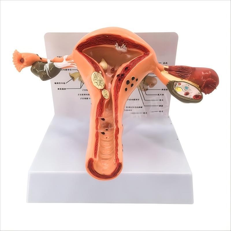 Model Anatomical Uterus Ovary Wanita / Peraga Anatomi Model Patologis Uterus Ovarium