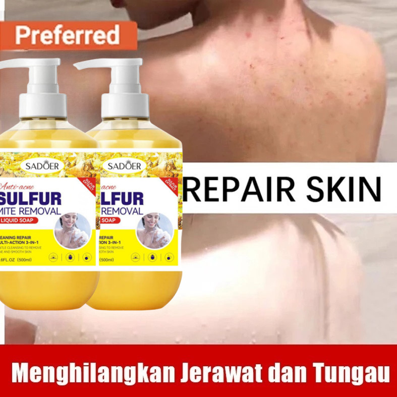 Eczema body wash 500ml Obat gatal gatal kulit Pengobatan Eksim psoriasis eksim kering Kurap gatal ku
