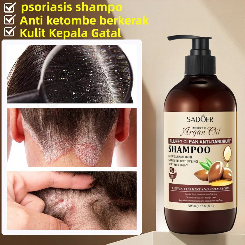 SADOER Shampo anti ketombe Penghilang Ketombe Berkerak Dan Gatal obat ketombe kerak kulit kepala oba