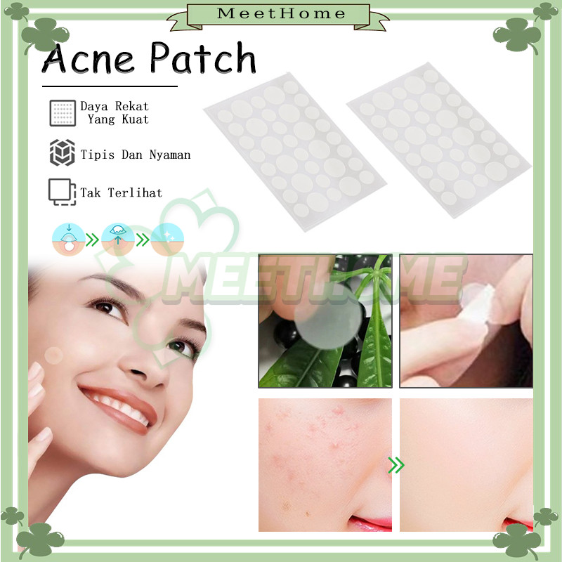 9PCS Acne Pimple Patch Stiker 36 PCS/Acne Patch/Acne Master Pimple Patch/Stiker Jerawat Transparan