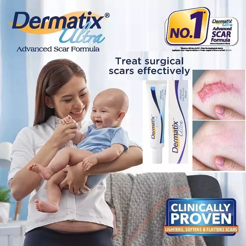 Dermatix Ultra Cream 15gr Penghilang Bekas Luka Operasi Keloid - Luka Lama - Bakar - Gatal Koreng De