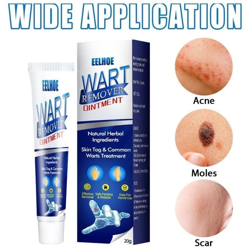 Sumifun EELHOE Wart Remover Cream Herbal Natural Ampuh Menghilangkan Kutil Dan Tahi Lalat