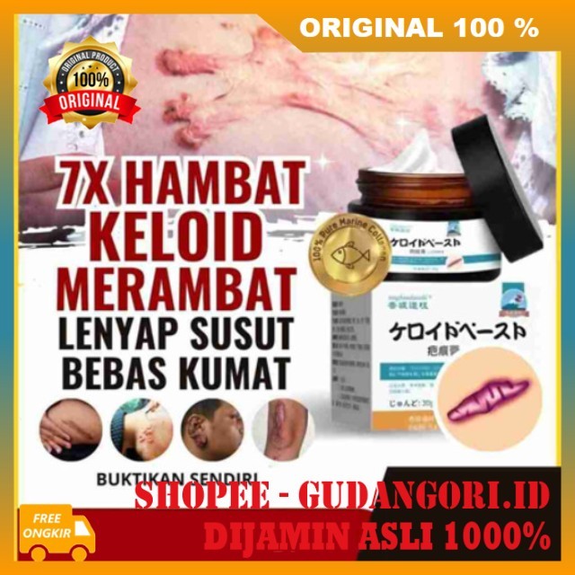 Keloscar Japan Salve Cream Penghilang Bekas Luka Krim Penghilang Keloid Bopeng Bekas Luka Ampuh ORIG