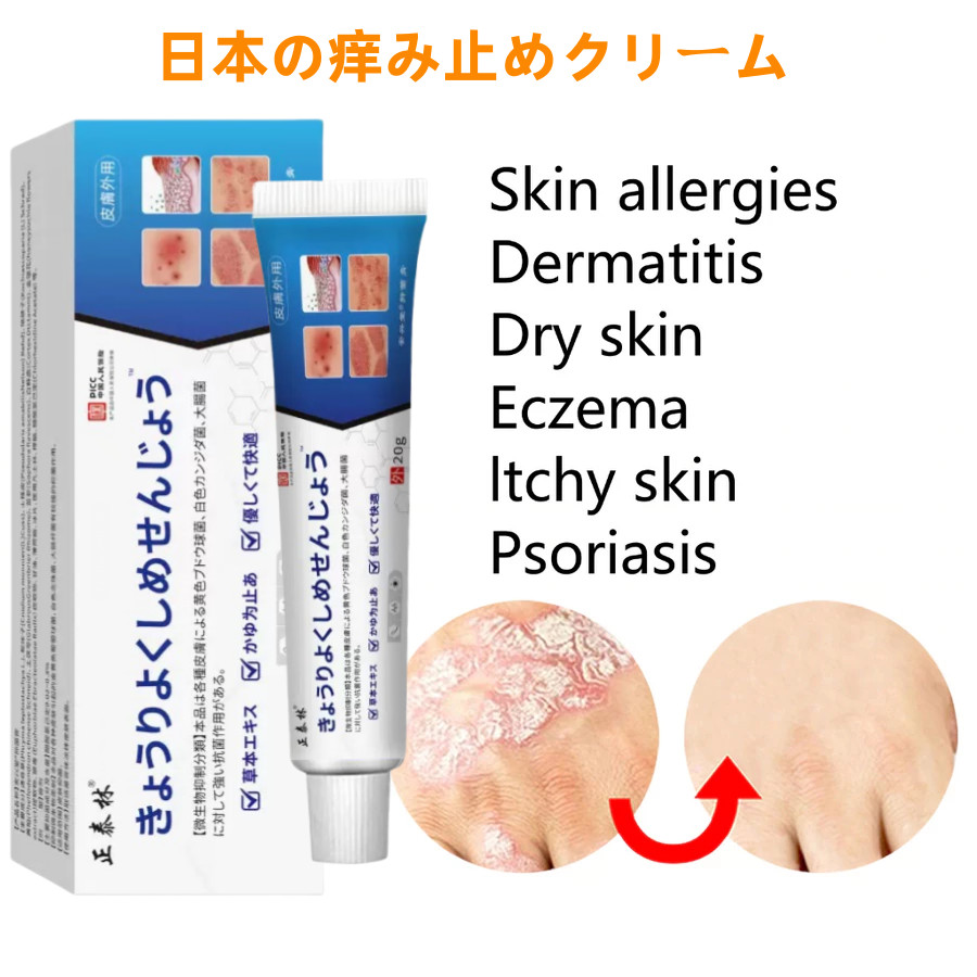 AMND Japan Salep Khusus Psoriasis Obat Gatal Eksim Krim psoriasis paling ampuh Kulit Kepala