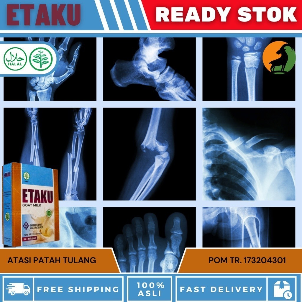 

Flashsale Etaku Disc 1 Box 45% Susu Sembuhkan Patah Tulang - Tulang Retak, Tulang Cedera, Tulang Keropos, Tulang Terasa Ngilu, Tulang belakang Sakit, Susu Penambah Kalsium - Susu Kambing Etaku - Untuk Anak, Dewasa, Ibu Hamil Dan Menyusui