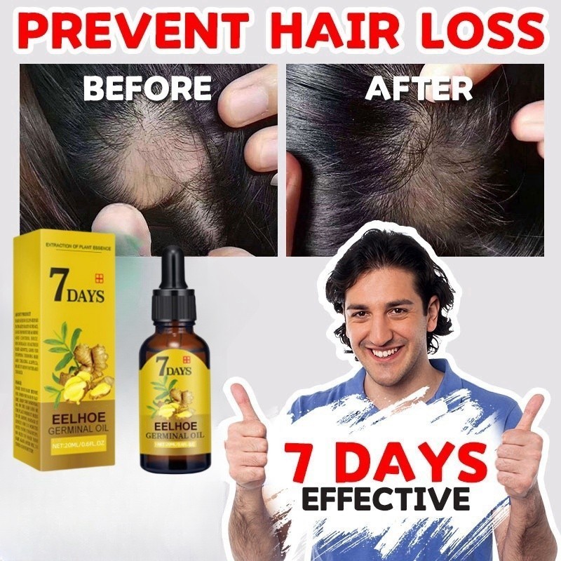 Kumis, Jambang 7 Days Serum Penumbuh Rambut Ginger Germinal Oil GINGER KING OIL 40ml Clothes of Skin