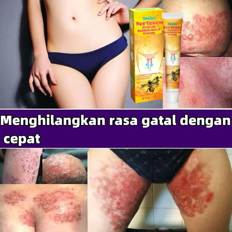 loli Salep gatal selangkangan obat gatal selangkangan obat gatal gatal salep gatal selangkangan obat