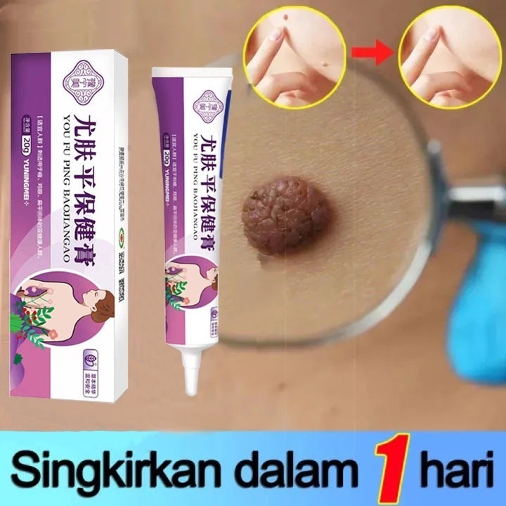 [Ori] Obat kutil penghilang kutil dan tahi lalat penghilang tahi lalat 20g obat kutil obat