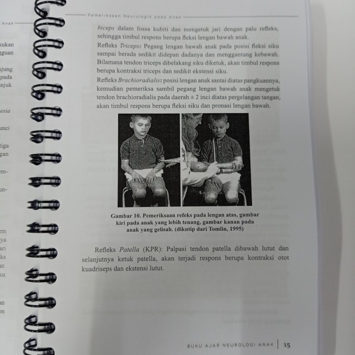 PROMO ~ Buku Kedokteran Buku Ajar Neurologi Anak