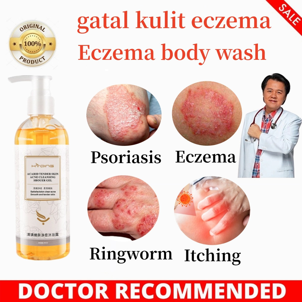 eczema body wash Pengobatan Eksim psoriasis eksim kering Kurap gatal kulit jamur kulit eksim lotion