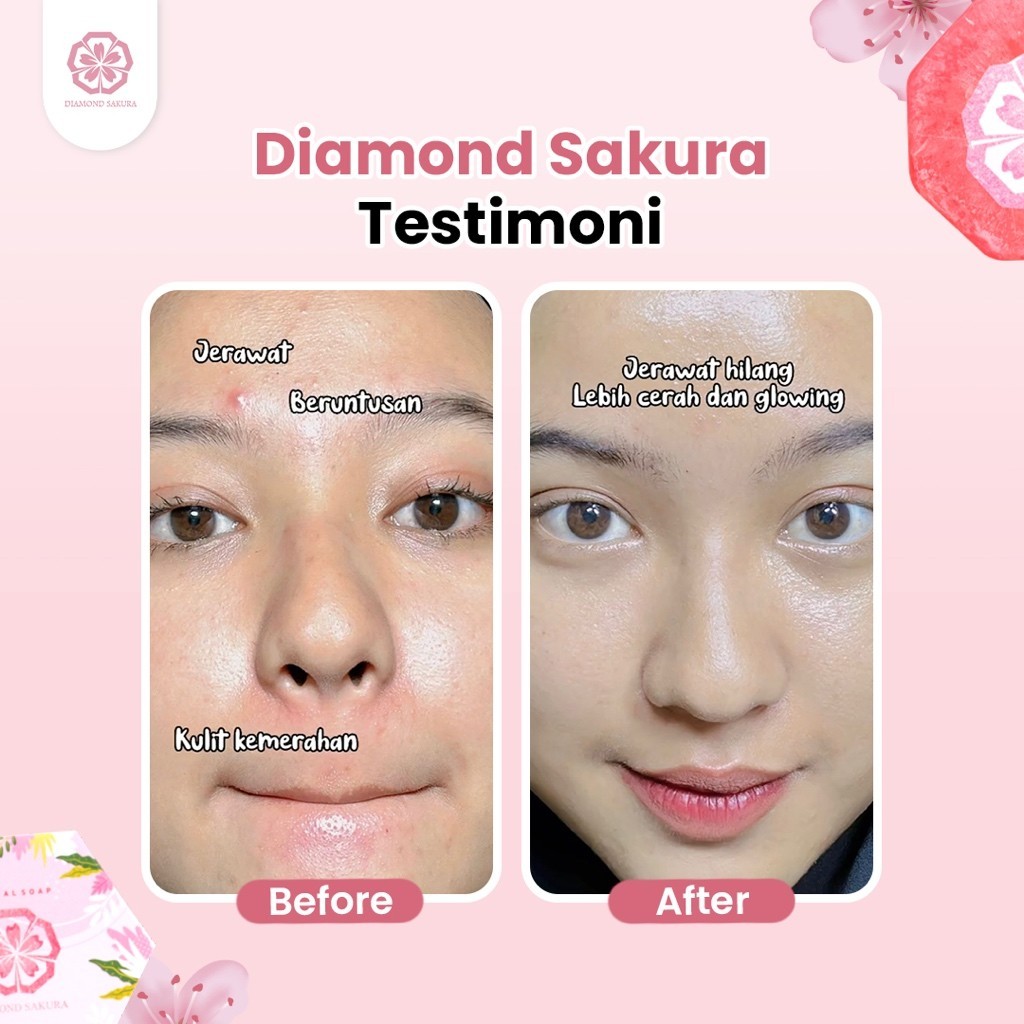 [1 PCS] Diamond Sakura - Soap Bar Sabun Wajah Glowing Pembersih Jerawat Sensitive Skin Solutions