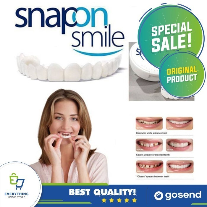 TERMURAH BOSKUU karet ikat kuat Snap On Smile ORIGINAL Authentic | Snap n Smile Gigi Palsu - Sepasan