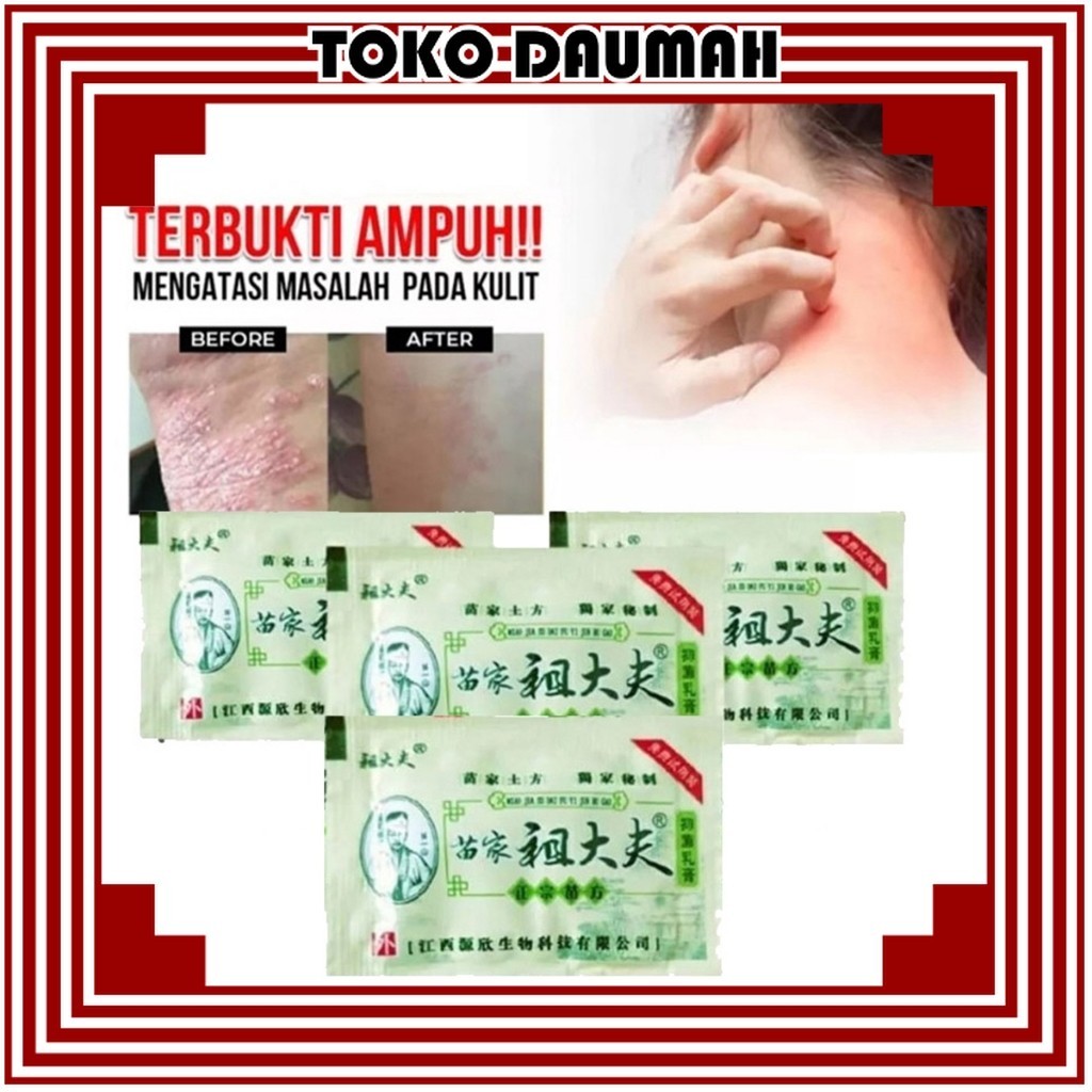 TD AMPUH ZUDAIFU Sachet Salep Gatal Anti Eksim Jamur Kurap Menghilangkan jerawat