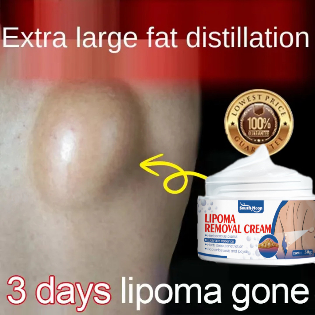 South moon Obat Benjolan Lipoma Obat herbal Cina Krim lipoma 50g Perawatan punggung/leher/paha Kanke