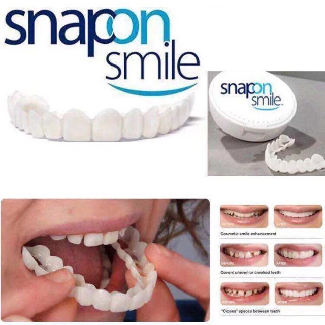 TERMURAH BOSKUU karet ikat kuat Terlaris Snap On Smile 100% Original Authentic / Gigi Palsu Snapon i